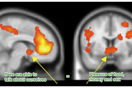 Brain activity