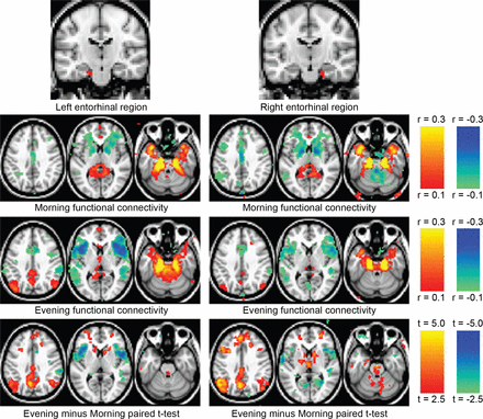 Brain scans