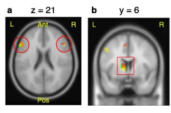 curiosity in the brain