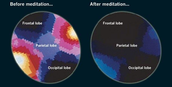 calming-mind-brain-waves make yourself happier